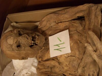 Mutated gene associated with colon cancer discovered in 18th-century Hungarian mummy